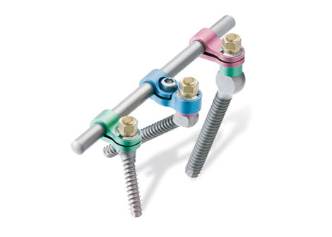 spine replacement product
